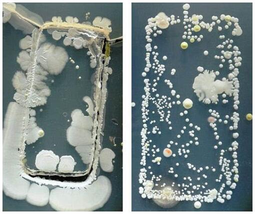 手機(jī)表面細(xì)菌 手機(jī)表面細(xì)菌