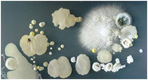 手機(jī)表面細(xì)菌 手機(jī)表面細(xì)菌