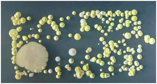 手機(jī)表面細(xì)菌 手機(jī)表面細(xì)菌